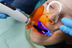 round rock dental fillings