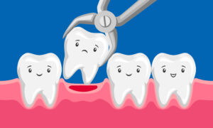 Round Rock , TX offers tooth extractions for kids 